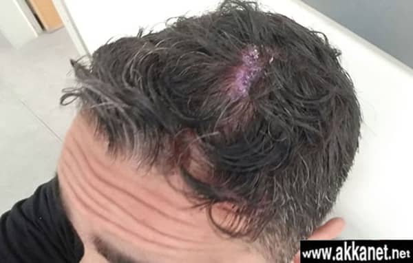 1630780880 Urbp08rwxf